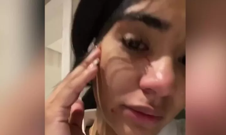 Daniela Cortes golpeada